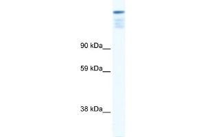 WB Suggested Anti-ZFP106 Antibody Titration: 0. (ZFP106 anticorps  (N-Term))