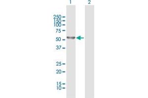Western Blot analysis of DYNC1LI2 expression in transfected 293T cell line by DYNC1LI2 MaxPab polyclonal antibody.