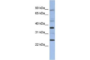 WB Suggested Anti-MAGEB3 Antibody Titration: 0. (MAGEB3 anticorps  (N-Term))