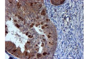 Image no. 3 for anti-RuvB-Like 2 (E. Coli) (RUVBL2) (AA 113-370) antibody (ABIN1490851)