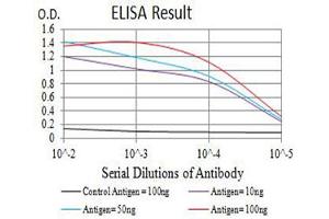 Black line: Control Antigen (100 ng),Purple line: Antigen (10 ng), Blue line: Antigen (50 ng), Red line:Antigen (100 ng)