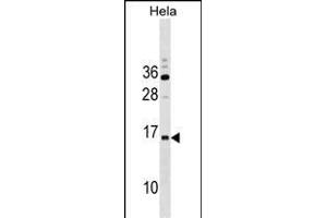 R Antibody (C-term) (ABIN1536834 and ABIN2838087) western blot analysis in Hela cell line lysates (35 μg/lane).