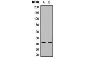 Western blot analysis of Smooth Muscle Actin expression in MCF7 (A), K562 (B) whole cell lysates.