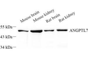 Western blot analysis of Angptl7 (ABIN7073049) at dilution of 1: 500 (ANGPTL7 anticorps)