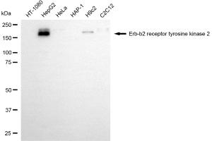 Western blotting analysis using erb-b2 receptor tyrosine kinase 2 antibody (ABIN7800158).
