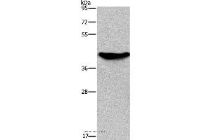 Western blot analysis of Human fetal liver tissue, using GALK1 Polyclonal Antibody at dilution of 1:450
