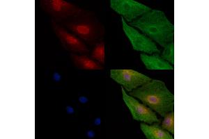 ABIN6260960 and ABIN6272912 staining  cells by IF/ICC.