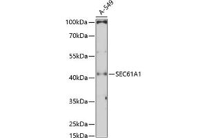 Western blot analysis of extracts of A-549 cells, using SEC61 Antibody (1614) at 1:3000 dilution. (SEC61A1 anticorps  (AA 310-420))