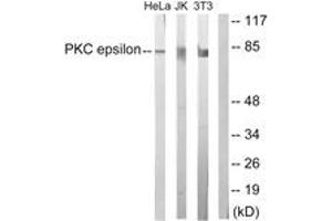 Western blot analysis of extracts from HeLa/Jurkat/3T3 cells, treated with PMA 125ng/ml 30', using PKC epsilon (Ab-729) Antibody. (PKC epsilon anticorps  (AA 688-737))