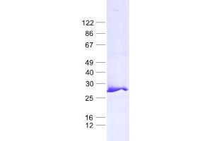 Validation with Western Blot