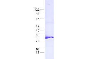 Validation with Western Blot (MRPL24 Protein (His tag))
