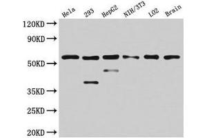 Western Blot Positive WB detected in: Hela whole cell lysate, 293 whole cell lysate, HepG2 whole cell lysate, NIH/3T3 whole cell lysate, LO2 whole cell lysate, Mouse brain tissue All lanes: PKM antibody at 4. (PKM anticorps  (AA 185-461))