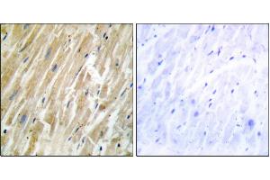 Immunohistochemistry analysis of paraffin-embedded human heart tissue using CALR antibody. (Calreticulin anticorps)