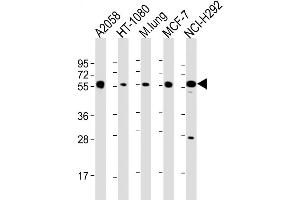 Western Blot at 1:2000 dilution Lane 1: A2058 whole cell lysate Lane 2: HT-1080 whole cell lysate Lane 3: mouse lung lysate Lane 4: MCF-7 whole cell lysate Lane 5: NCI-H292 whole cell lysate Lysates/proteins at 20 ug per lane. (MMP14 anticorps  (N-Term))