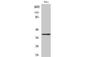 Western Blotting (WB) image for anti-Very-Long-Chain Enoyl-CoA Reductase-Like (LOC101508101) (Internal Region) antibody (ABIN3187049) (SR-5A anticorps  (Internal Region))