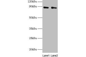 Western blot All lanes: CFB antibody at 2 μg/mL Lane 1: K562 whole cell lysate Lane 2: HepG2 whole cell lysate Secondary Goat polyclonal to rabbit IgG at 1/10000 dilution Predicted band size: 86, 69 kDa Observed band size: 86 kDa (Complement Factor B anticorps  (AA 26-751))
