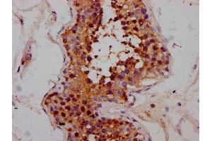 IHC image of ABIN7168374 diluted at 1:300 and staining in paraffin-embedded human testis tissue performed on a Leica BondTM system. (MEX3B anticorps  (AA 253-375))
