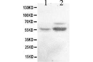 Western blot analysis of ALDH1A2 expression in rat testis extract ( Lane 1) and mouse testis extract ( Lane 2). (ALDH1A2 anticorps  (AA 1-110))
