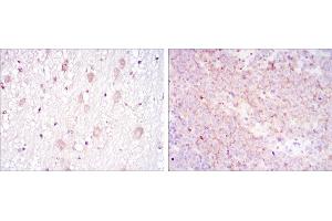 Immunohistochemical analysis of paraffin-embedded brain tissues (left) and submaxillary tumor tissues (right) using CD1A mouse mAb with DAB staining.