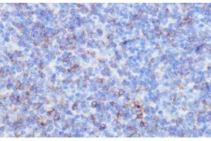 Immunohistochemistry of paraffin-embedded Mouse spleen using NOTCH3 Polyclonal Antibody at dilution of 1:100 (40x lens). (NOTCH3 anticorps)