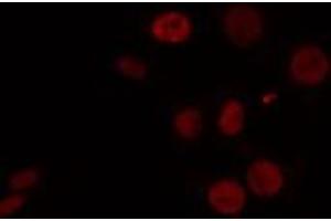 ABIN6274460 staining HeLa cells by IF/ICC. (CELF1 anticorps  (N-Term))