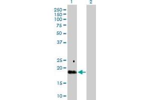 Western Blot analysis of TGFA expression in transfected 293T cell line by TGFA MaxPab polyclonal antibody. (TGFA anticorps  (AA 1-160))