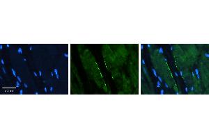 Rabbit Anti-CLPTM1L Antibody   Formalin Fixed Paraffin Embedded Tissue: Human heart Tissue Observed Staining: Plasma membrane Primary Antibody Concentration: N/A Other Working Concentrations: 1:600 Secondary Antibody: Donkey anti-Rabbit-Cy3 Secondary Antibody Concentration: 1:200 Magnification: 20X Exposure Time: 0.