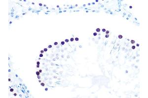 Immunohistochemistry of paraffin-embedded mouse testis using K/H Rabbit mAb (ABIN7267702) at dilution of 1:100 (40x lens).