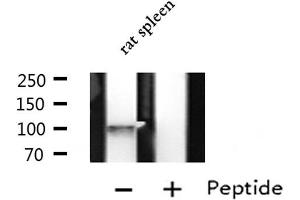 Western blot analysis of extracts from Rat spleen lysate, using LRP8 antibody. (LRP8 anticorps  (Internal Region))