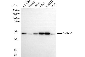 Western blotting analysis using CAMK2D antibody (ABIN7797835). (Recombinant CAMK2D anticorps)
