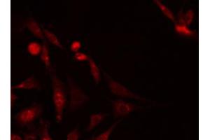 ABIN6267703 staining Hela by IF/ICC.