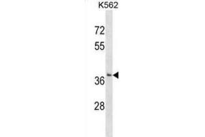 Western Blotting (WB) image for anti-Single-Strand-Selective Monofunctional Uracil-DNA Glycosylase 1 (SMUG1) antibody (ABIN2999446) (SMUG1 anticorps)