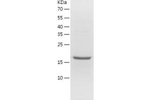 Western Blotting (WB) image for Hematopoietic Prostaglandin D Synthase (HPGDS) (AA 2-199) protein (His-IF2DI Tag) (ABIN7123287)