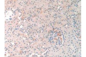 IHC-P analysis of Rat Kidney Tissue, with DAB staining. (SERPINA10 anticorps  (AA 278-425))