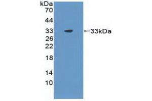 Western blot analysis of recombinant Rat CIDEC. (CIDEC anticorps  (AA 1-221))