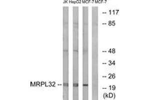 Western Blotting (WB) image for anti-Mitochondrial Ribosomal Protein L32 (MRPL32) (AA 101-150) antibody (ABIN2890054)