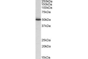 ABIN2561032 (0. (ALDH2 anticorps  (Internal Region))