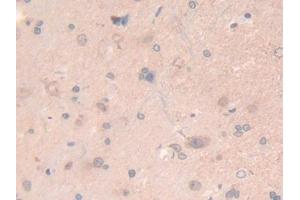 DAB staining on IHC-P; Samples: Rat Spinal cord Tissue (LAMB2 anticorps  (AA 75-223))