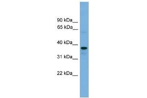 WB Suggested Anti-VPS16 Antibody Titration: 0. (VPS16 anticorps  (N-Term))