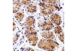 Immunohistochemical analysis of Kua staining in human stomach formalin fixed paraffin embedded tissue section. (TMEM189 anticorps)