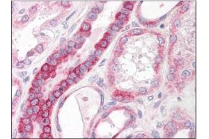 Human Kidney: Formalin-Fixed, Paraffin-Embedded (FFPE)