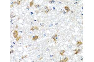 Immunohistochemistry of paraffin-embedded Rat brain using PIP4K2B Polyclonal Antibody at dilution of 1:100 (40x lens).