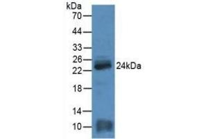 Detection of MYL4 in Rat Heart Tissue using Polyclonal Antibody to Myosin Light Chain 4, Alkali, Atrial, Embryonic (MYL4)