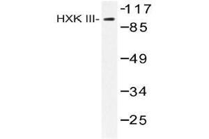 Western blot (WB) analysis of HXK III antibody in extracts from Jurkat insulin 0. (HK3 anticorps)