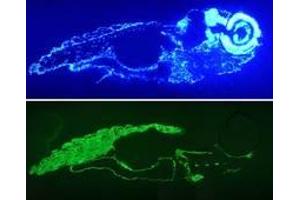 Image no. 1 for anti-Actin, alpha 1, Skeletal Muscle (ACTA1) antibody (ABIN1502284)