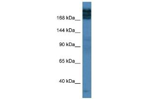 Western Blot showing TPR antibody used at a concentration of 1 ug/ml against Fetal Lung Lysate (TPR anticorps  (C-Term))