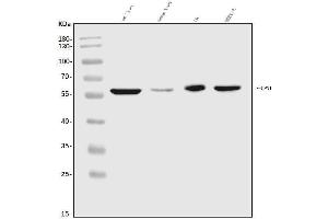 Western blot analysis of CPN1 using anti-CPN1 antibody (ABIN7600158).