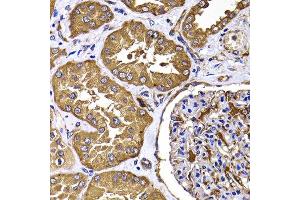 Immunohistochemistry of paraffin-embedded human kidney using TGS1 antibody at dilution of 1:100 (40x lens). (TGS1 anticorps)