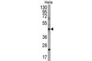Western Blotting (WB) image for anti-Chitinase Domain Containing 1 (CHID1) antibody (ABIN2999239) (CHID1 anticorps)
