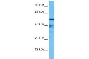 Host:  Mouse  Target Name:  GFI1  Sample Tissue:  Mouse Liver  Antibody Dilution:  1ug/ml (GFI1 anticorps  (N-Term))